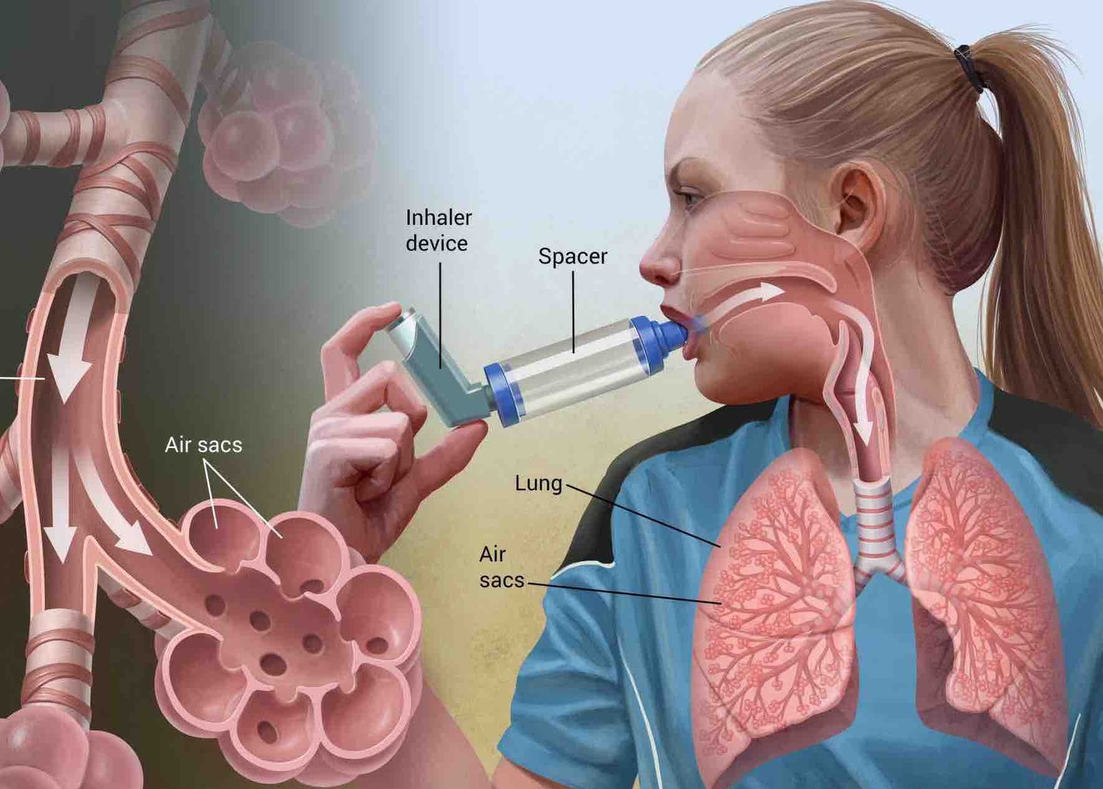 Inhaler Asma